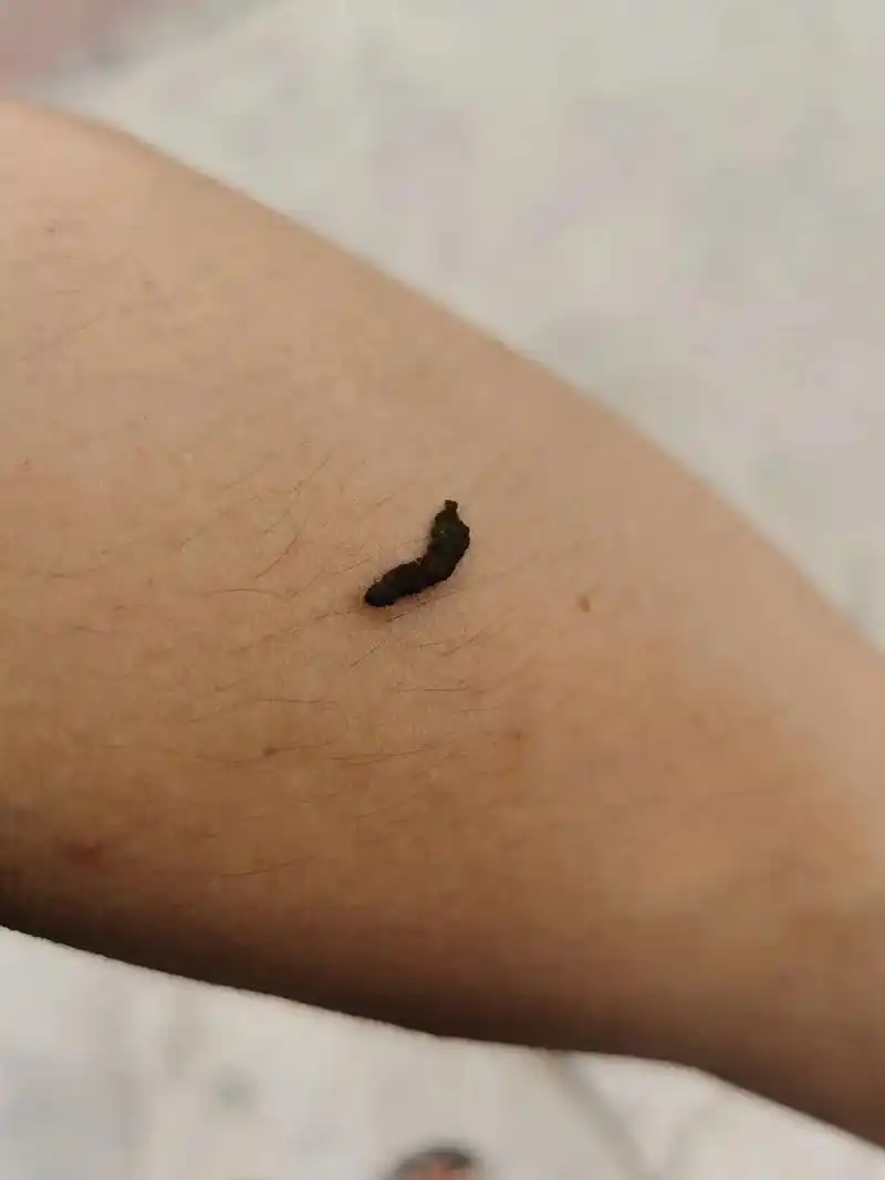 而是不对的,因为小鸟在天空中飞翔, 圆 掉下屎,屎也就是粪便 - 抖音